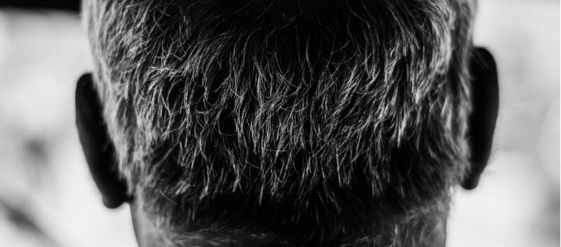 بهبود سفیدی مو با محصولات فوراور